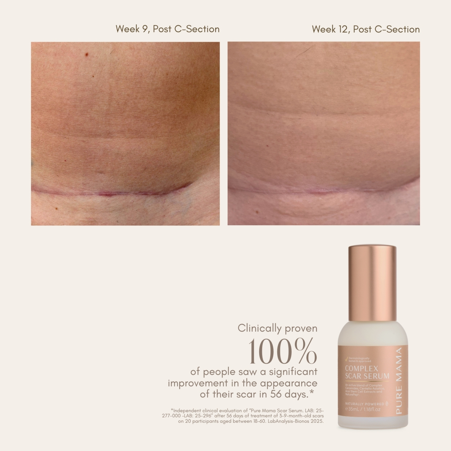 Complex Scar Serum