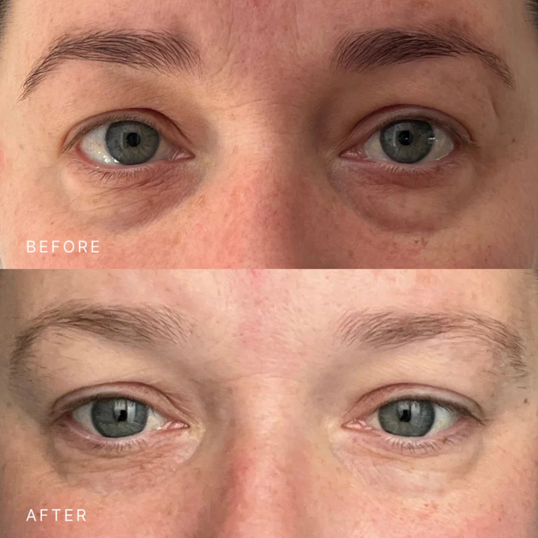 Triple Peptide Eye Cream