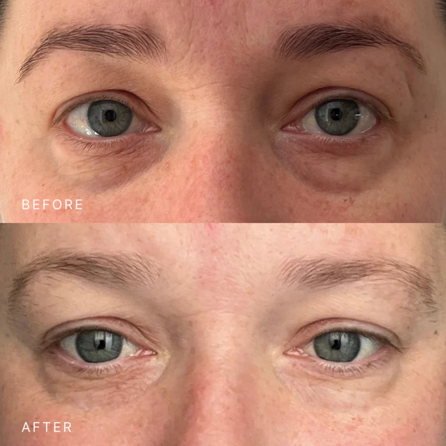 Triple Peptide Eye Cream